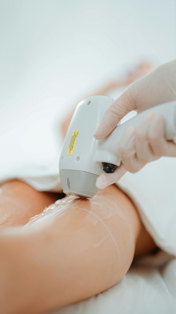 Pourquoi choisir l'épilation laser des jambes pour un résultat durable